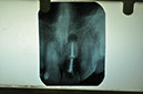 %_tempFileNameImplant%2061a3%
