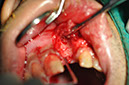 %_tempFileNameImplant%2061b1%