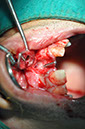 %_tempFileNameImplant%2061b2%