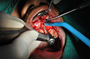%_tempFileNameImplant%2061b3%