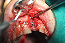 %_tempFileNameImplant%2061b4%