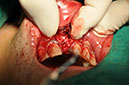 %_tempFileNameImplant%2061b5%
