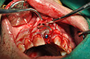 %_tempFileNameImplant%2061b6%