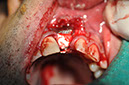 %_tempFileNameImplant%2061b7%