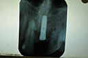 %_tempFileNameImplant%2061b8%