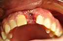 %_tempFileNameImplant%2061b9%