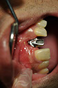%_tempFileNameImplant%2061c1%