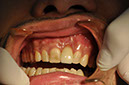 %_tempFileNameImplant%2061c2%