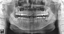 %_tempFileNameImplant%2061d1%