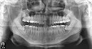 %_tempFileNameImplant%2061d2%