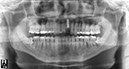 %_tempFileNameImplant%2061d3%