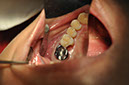 %_tempFileNameImplant%2064a2%