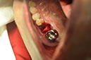 %_tempFileNameImplant%2064a3%