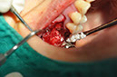%_tempFileNameImplant%2064b1%