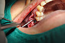 %_tempFileNameImplant%2064b2%
