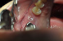 %_tempFileNameImplant%2064b3%