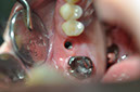 %_tempFileNameImplant%2064c1%