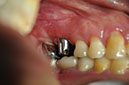 %_tempFileNameImplant%2064c2%
