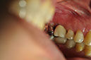 %_tempFileNameImplant%2064c3%
