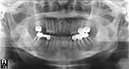 %_tempFileNameImplant%2064d1%