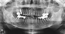%_tempFileNameImplant%2064d2%