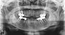 %_tempFileNameImplant%2064d3%