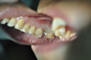 %_tempFileNameImplant%2065a1%