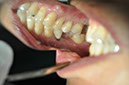 %_tempFileNameImplant%2065a2%
