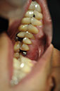 %_tempFileNameImplant%2065b1%