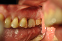 %_tempFileNameImplant%2065b2%