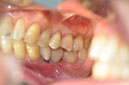 %_tempFileNameImplant%2065c1%