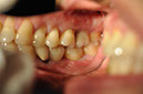 %_tempFileNameImplant%2065c3%