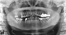 %_tempFileNameImplant%2065d1%