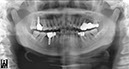 %_tempFileNameImplant%2065d2%