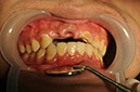 %_tempFileNameImplant%2066a1%