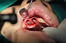 %_tempFileNameImplant%2066a3%