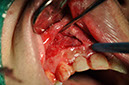 %_tempFileNameImplant%2066b2%