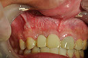 %_tempFileNameImplant%2066b6%