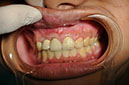 %_tempFileNameImplant%2066c1%