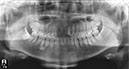%_tempFileNameImplant%2066d1%