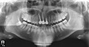 %_tempFileNameImplant%2066d3%