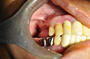 %_tempFileNameImplant%2067a1%