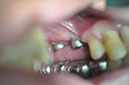%_tempFileNameImplant%2067b1%