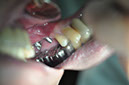 %_tempFileNameImplant%2067b2%