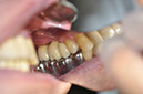 %_tempFileNameImplant%2067c1%