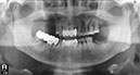 %_tempFileNameImplant%2067d1%