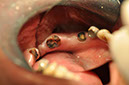 %_tempFileNameImplant%2068a2%