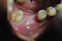 %_tempFileNameImplant%2068a4%