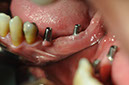 %_tempFileNameImplant%2068b1%