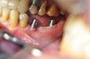 %_tempFileNameImplant%2068b2%